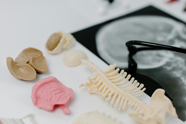 Variation non-unique pour es-salud-adelgazamiento